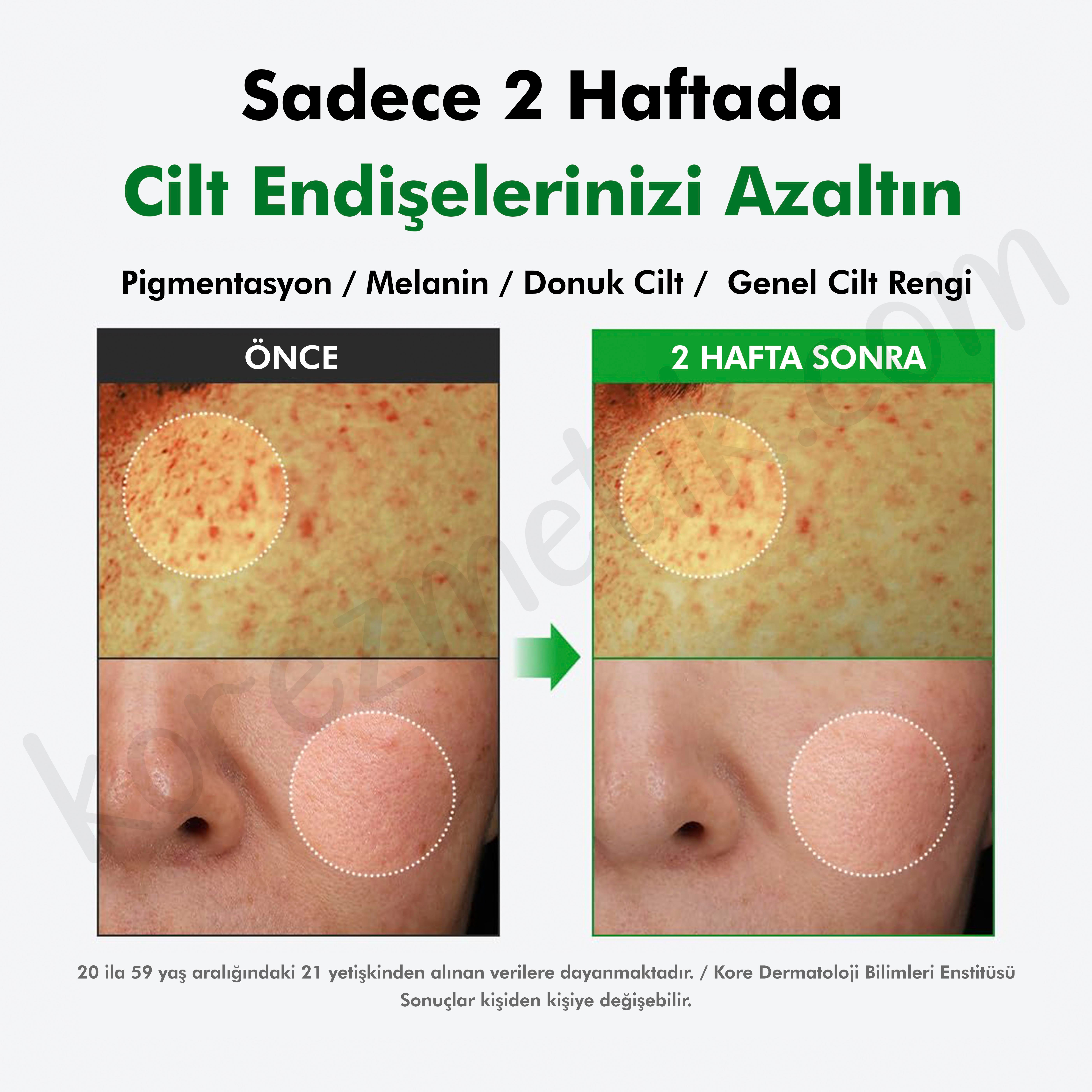 Dr. Althea %20 Gentle Vitamin C Serum - Leke Ve Akne Karşıtı - 30ml 