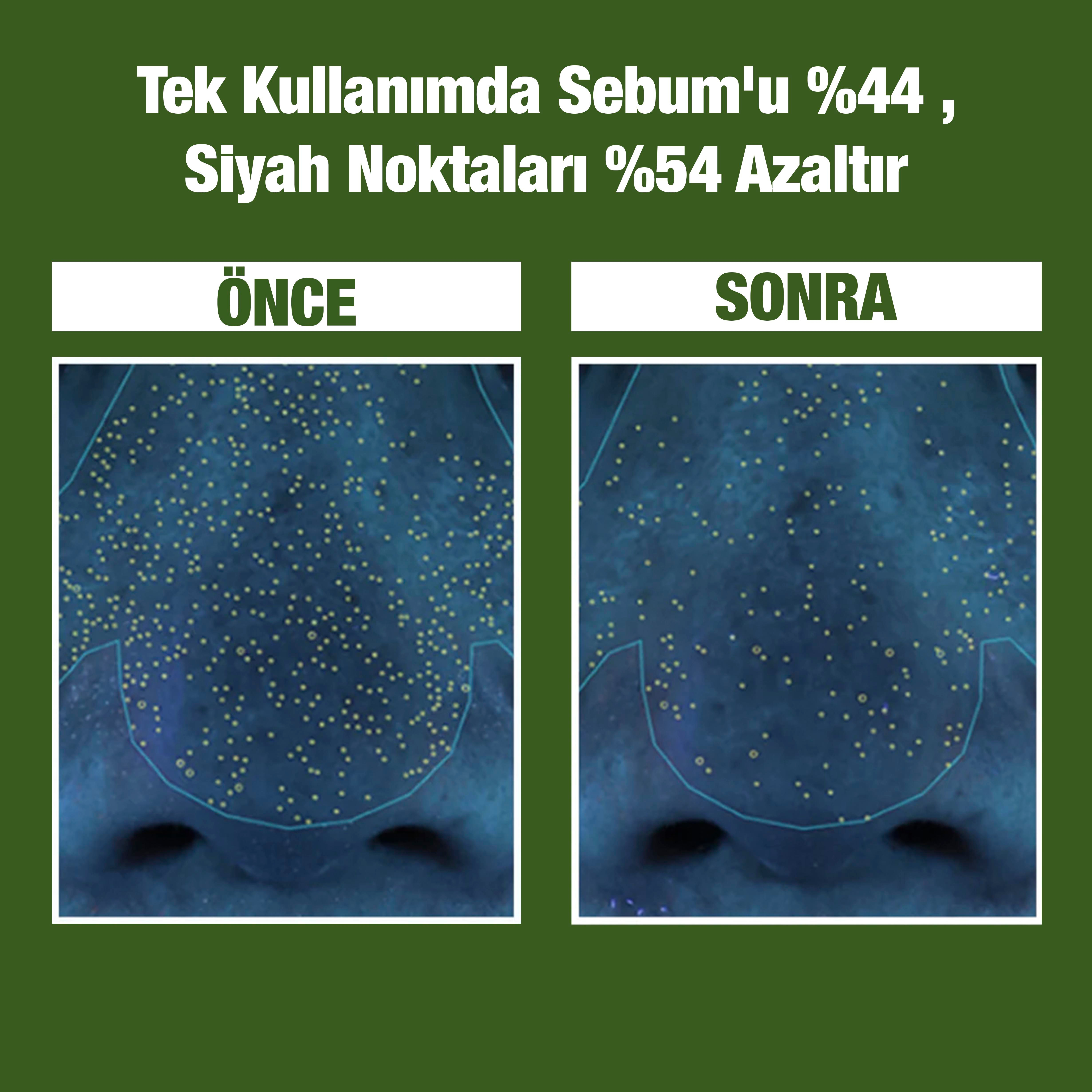 P.Calm Gözenek Karşıtı, Arındırıcı, Yatıştırıcı, Nemlendirici Kabarcık Oluşturarak Köpüren Holy Basil Bubble Deep Maske - 90gr