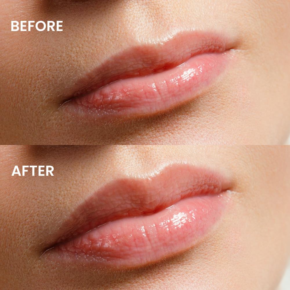 HYPE LIP PLUMPING LIP GLOSS DUDAK PARLATICI