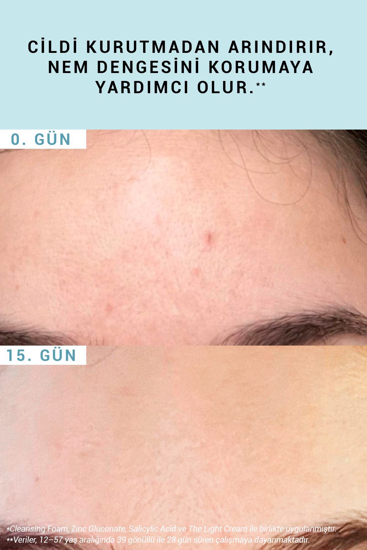 Gentle Cleansing Foam Tüm Ciltler Arındırıcı Yüz Temizleme Köpüğü 150 ml
