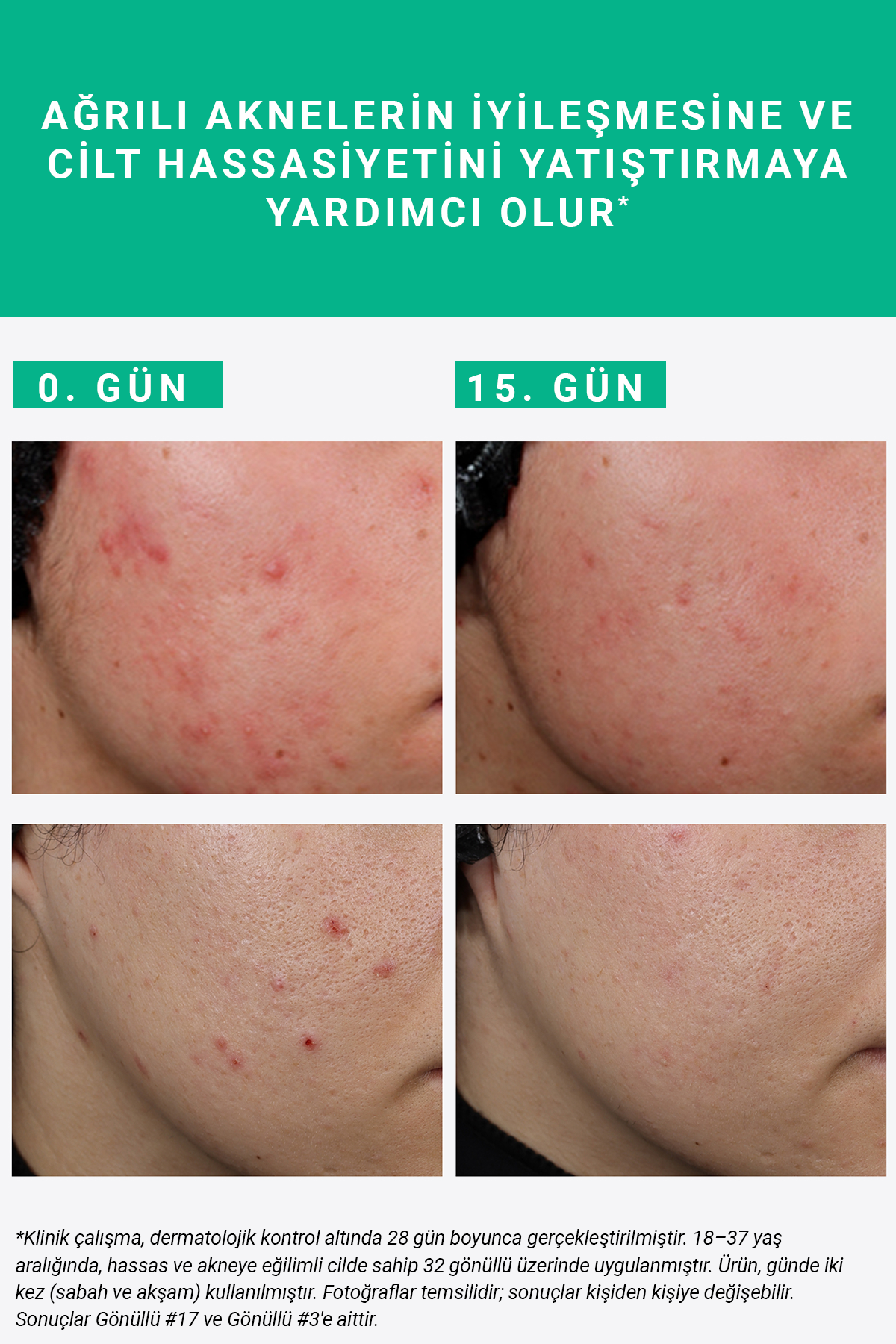 PURE ACTIVE SUCCINIC ACID 15 ML