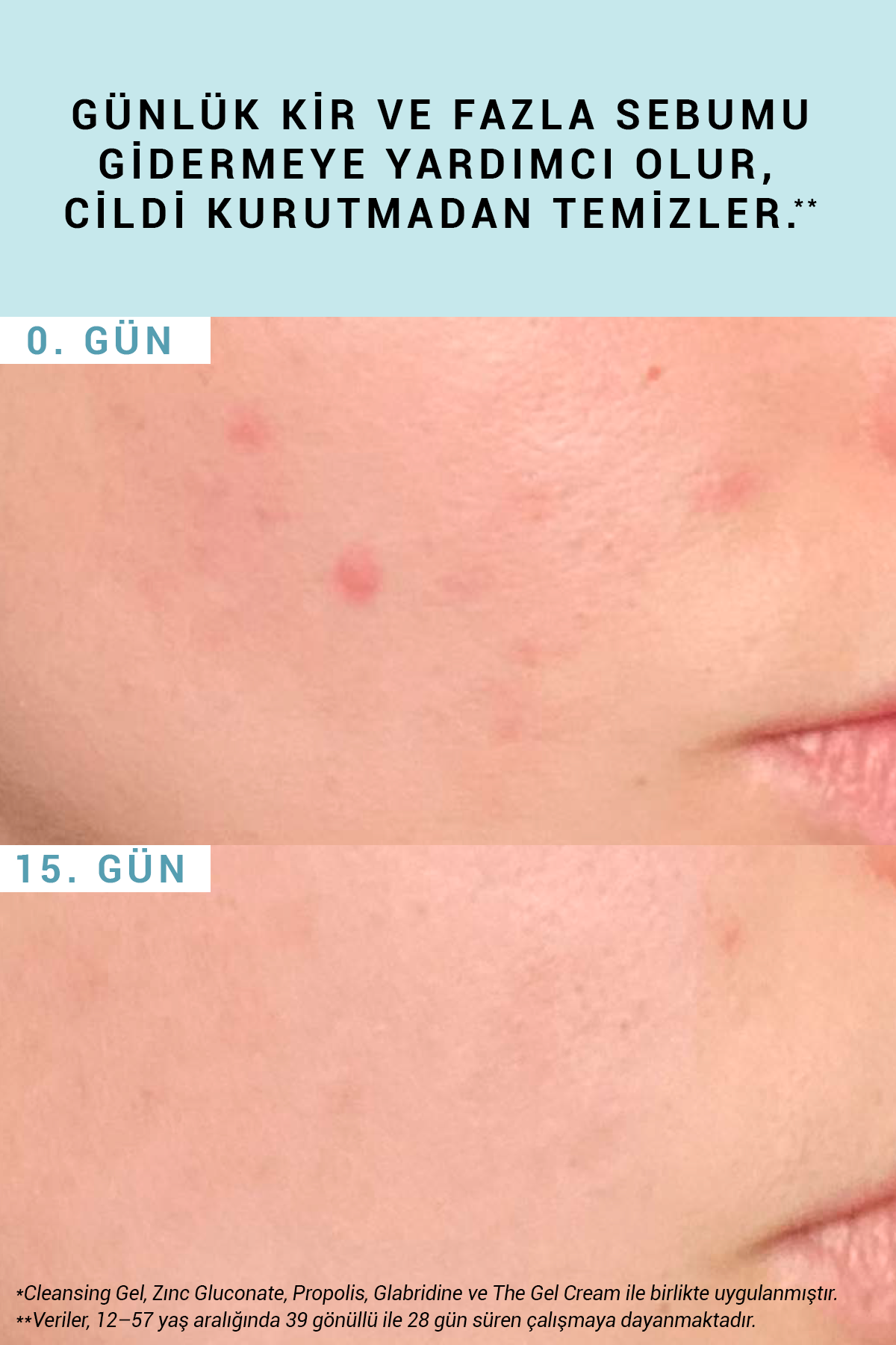 Purifying Cleansing Gel Arındırıcı Temizleme Jeli 200 ml