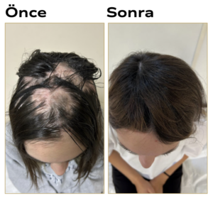 Celestina Derma Hair Support