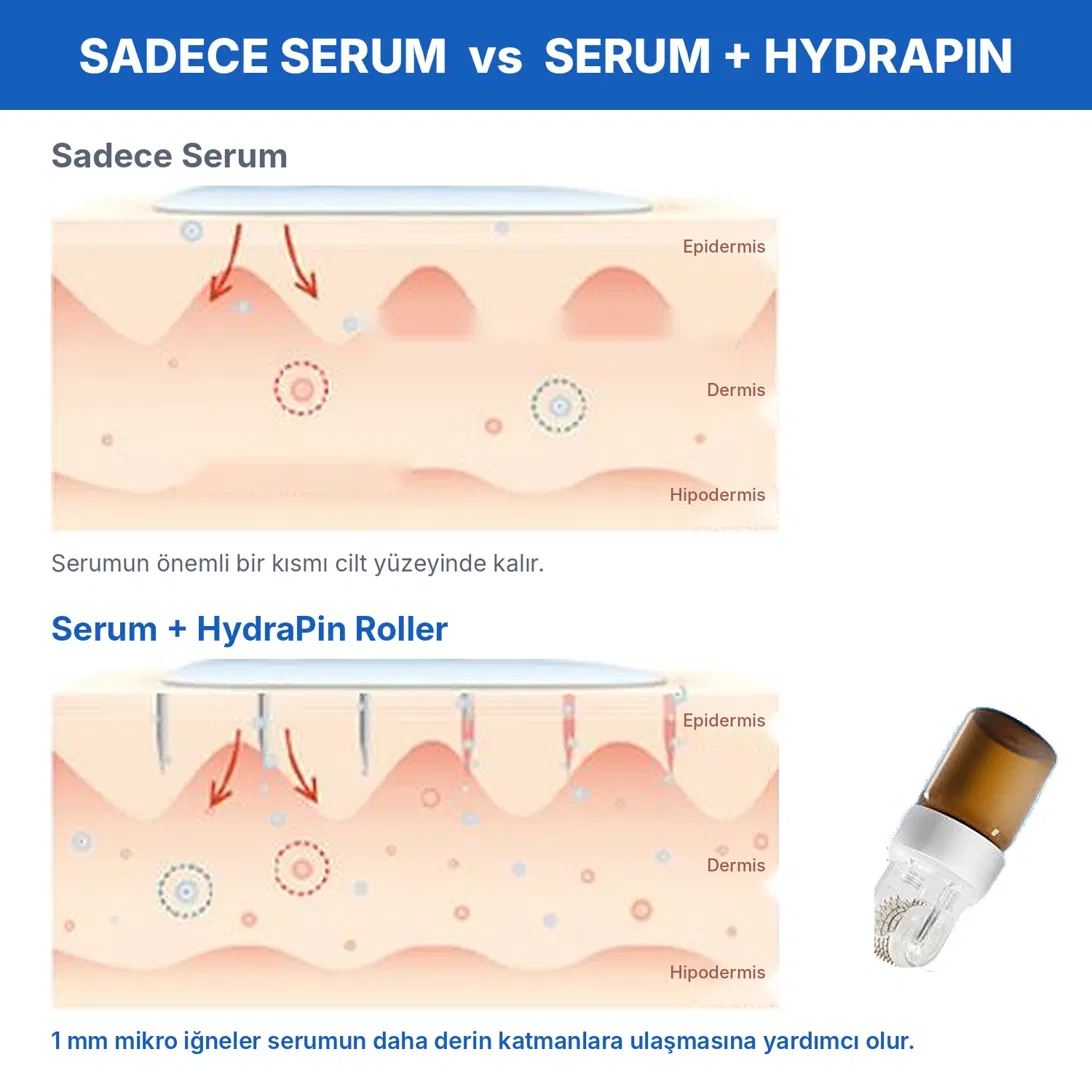HYDRAPIN Roller