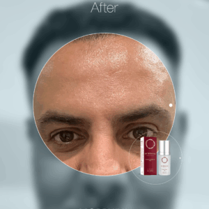 MORPHIYA - Exomorphic Biotech™ SOS Eksozom Kremi