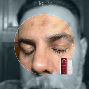MORPHIYA - Exomorphic Biotech™ SOS Eksozom Kremi