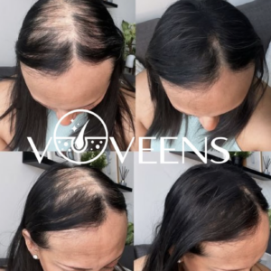 Voveens Stemcell Hair Mix Serum