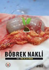 Böbrek Nakli