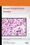 Mesane Biyopsilerinin Yorumu - Biyopsi Yorumları Serisi