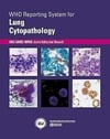 Who Reporting System For Lung Cytopathology (who R