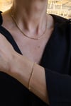 Yenigün Kuyumculuk14 Ayar Altın Top Detaylı Balıksırtı Set ZSM025
