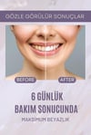 Billion Dollar Smile Teeth Whitening Kit Dis Beyazlatici Set