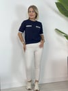 7129 ELİS, PAÇA DETAY JEAN