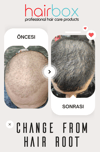 Hairbox Erkek Saç Serumu (3 Adet Serum + 1 Adet Dermoroller Hediye)