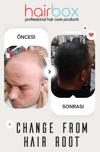 Hairbox Erkek Saç Serumu ( 3 Adet Serum + 1 Adet Dermaroller + 1 Adet Şampuan)