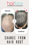Hairbox Erkek Saç Serumu ( 3 Adet Serum + 1 Adet Dermaroller + 1 Adet Şampuan)