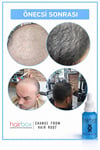 Hairbox Erkek Saç Serumu (5 Adet Serum +1 Dermoroller)