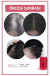 Hairbox Kadın Saç Serumu (3 Adet Serum, 1 Adet Şampuan, 1 Adet Roller)