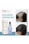 Kalıcı Etki Hızlı Sonuç- Hair Box Saç Çıkarıcı Serum / 1 Adet Serum / 1x50ml