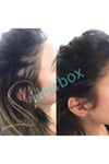Kalıcı Etki Hızlı Sonuç- Hair Box Saç Çıkarıcı Serum / 1 Adet Serum / 1x50ml