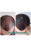 Kalıcı Etki Hızlı Sonuç- Hair Box Saç Çıkarıcı Serum / 1 Adet Serum / 1x50ml