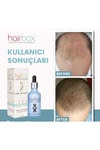 Kalıcı Etki Hızlı Sonuç- Hair Box Saç Çıkarıcı Serum / 1 Adet Serum / 1x50ml