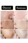Kapsül Serum C Vitaminli