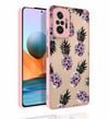Xiaomi Redmi Note 10 Pro Kılıf Desenli Kamera Korumalı Parlak Zore Nora Kapak