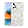 Xiaomi Redmi Note 10 Pro Kılıf Simli Desenli Kamera Korumalı Parlak Zore Popy Kapak