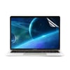 Zore MacBook 13.3' Air 2020 Ekran Koruyucu 2 Adet