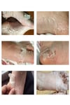 Ayak Peeling Maskesi – Nasır, Ölü Deri, Giderici, Nemlendirici Lavanta Özlü Maske