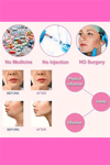 Ayarlanabilir V-Şekilli Yüz Kaldırma Bandı (Unisex) – Çift Çene Azaltıcı, Nazolabiyal Kırışıklık Sıkılaştırıcı, Nefes Alabilen & Kokusuz, Hipoalerjenik Kumaş,