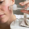 Çarşı PointMikro İğne 64’lü Cilt Bakım Serumu – Yüz ve Boyun için Anti-Aging, Gözenek Sıkılaştırıcı Serum
