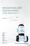 The Purest Solutions Siyah Nokta Ve Sivilce Karşıtı Niacinamide Cilt Bakım Serumu 30 Ml (niacinamide 5% & Zinc Pca 1%)