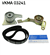 TRİGER SETİ 136X25MM CITROEN BERLINGO 1.9 D 96-03, PEUGEOT PARTNER 1.9 D 96-02