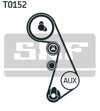 TRİGER SETİ 153X25MM AUDI A4 B5 1.8 94-00, 1.8 QUATTRO 95-00, A6 1.8 95-97, A6 1.8 97-05, VOLKSWAGEN PASSAT B5 1.8 96-00, 1.8 T 96-00 