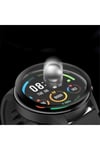 Mi Watch Color NVTH PMMA Pet Saat Ekran Koruyucu - Siyah