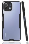 Xiaomi Mİ 11 Lite Kılıf Platin Silikon - Siyah