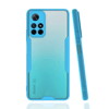 Xiaomi Redmi Note 11T Kılıf Platin Silikon - Mavi