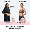 30 Adet Kilo Yönetimi Destek Bantları – İştah Kontrolü Ve Günlük Wellness Desteği Bx40