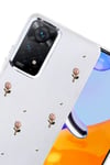 Mey İthalat®   Redmi Note 11 Pro Fiyonk Desenli Kapak - Desen 6