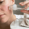 Mikro İğne 64’lü Cilt Bakım Serumu – Yüz Ve Boyun İçin Anti-aging, Gözenek Sıkılaştırıcı Serum Bx40