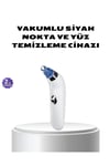 Vakumlu Siyah Nokta Temizleme Cihazı – 5 Kademe Güç ve 4 Başlıklı Derin Cilt Bakımı