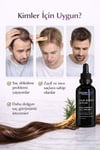 3lü Erkek Saç Dökülme Karşıtı Serum 50 ml | Kök Güçlendirici Bakım