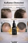Saç Köklerini Destekleyen Serum 50 ml | Yoğun Bakım & Güçlendirici