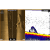 StructureScan® 3D Modül + Transducer
