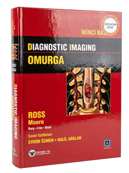 Diagnostic Imaging - Omurga