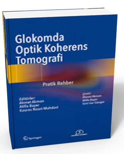 Glokomda Optik Koherens Tomografi