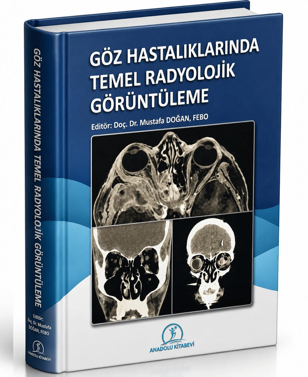 Göz Hastalıklarında Temel Radyolojik Görüntüleme