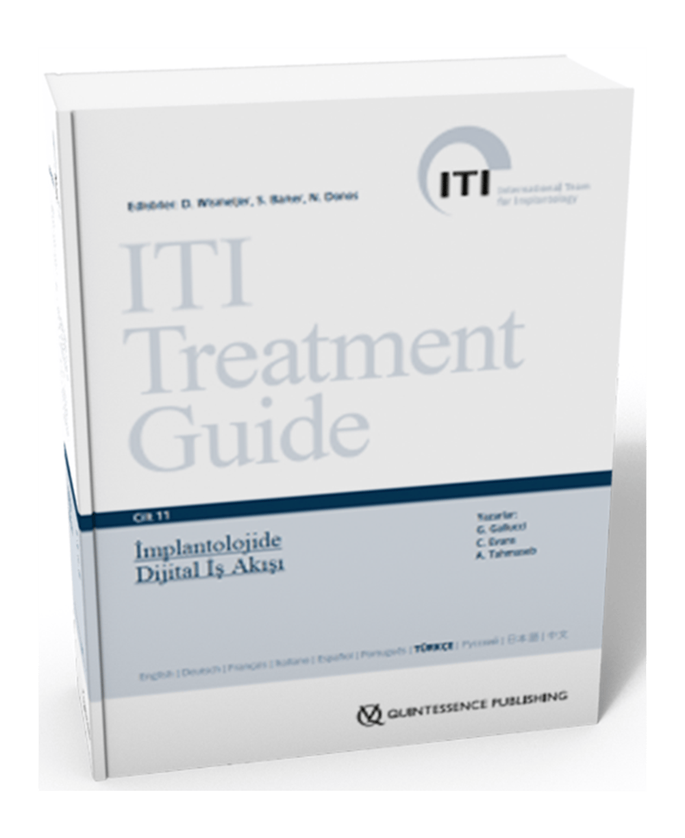 ITI Treatment Guide VOL 11 - İmplantolojide Dijital İş Akışı